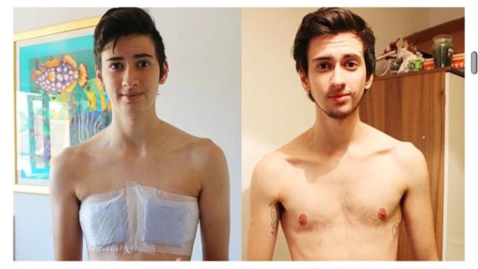 Yeni yapılan penis boyu açıklandı!! Sizce normal mi?