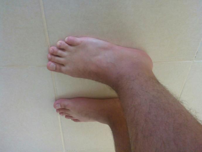 Düz taban nedir düz tabanmıyım.?