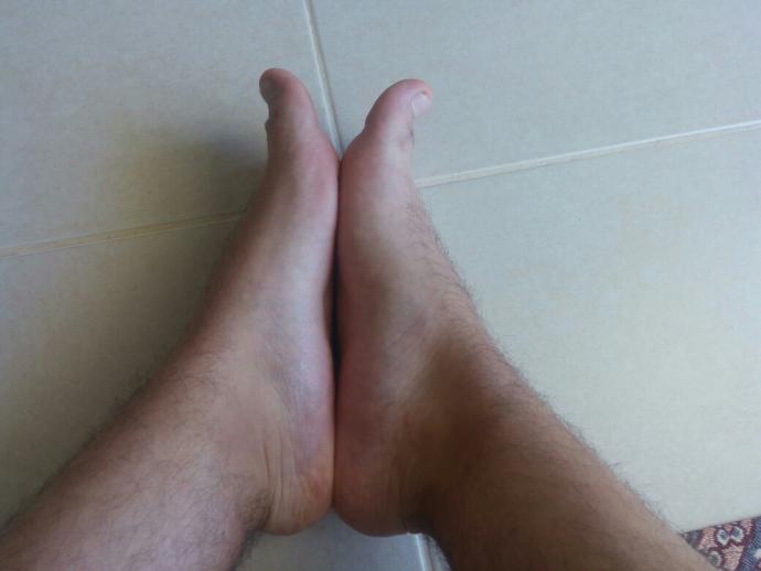 Düz taban nedir düz tabanmıyım.?