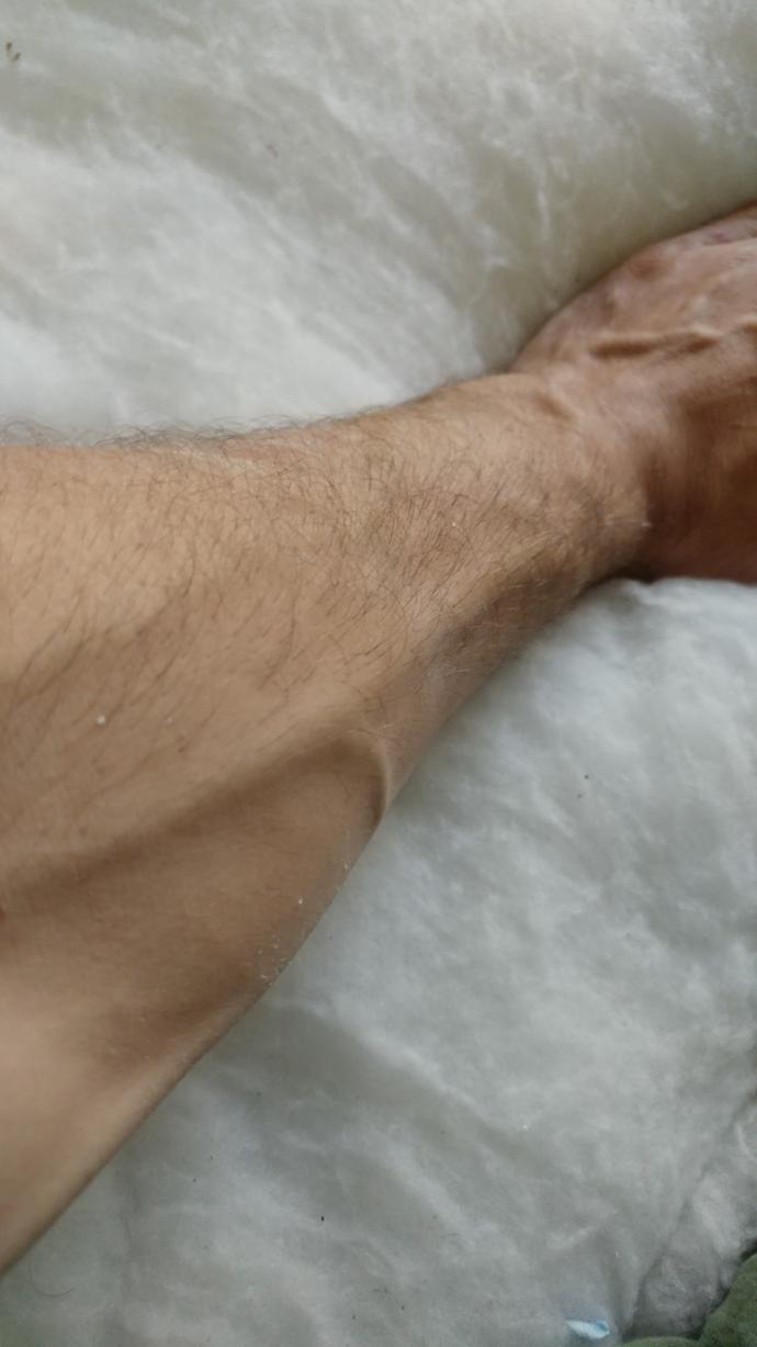 Damarlı kolu çekici buluyor musunuz?