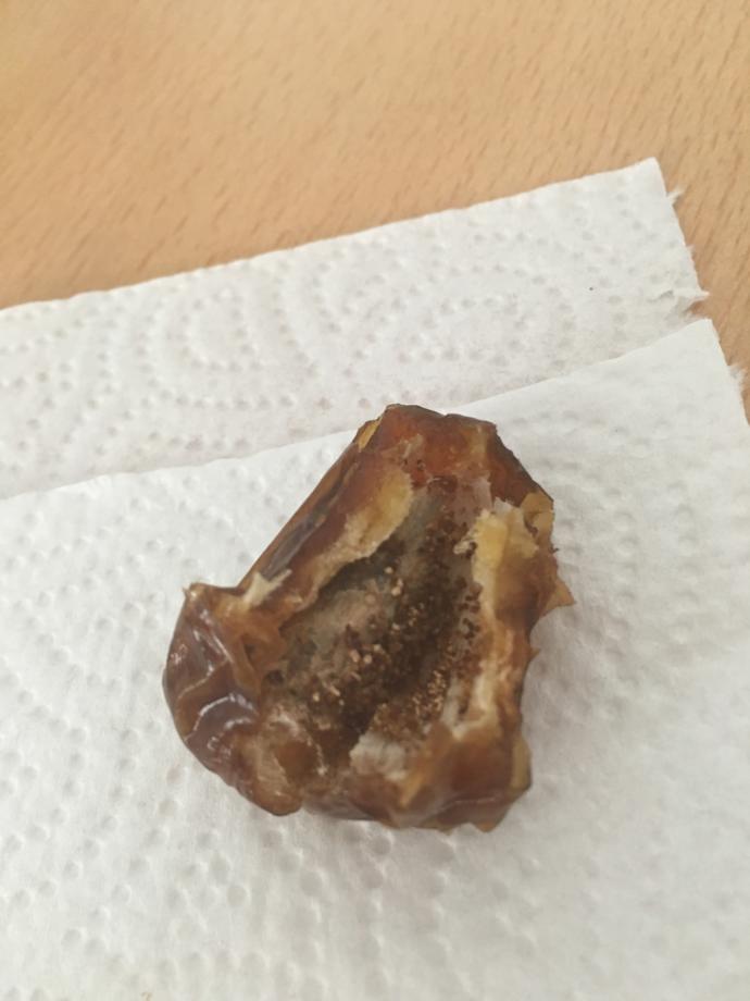 hurmanın içindeki bu şeyler ne?