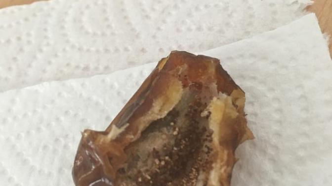 Hurmanın içindeki bu şeyler ne?