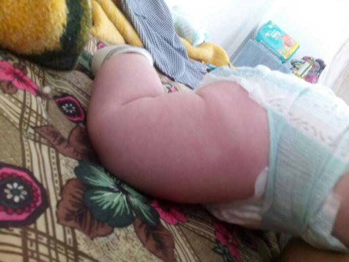 Günaydın sizce 4 aylık için bu bacak kalın mı normal mi??