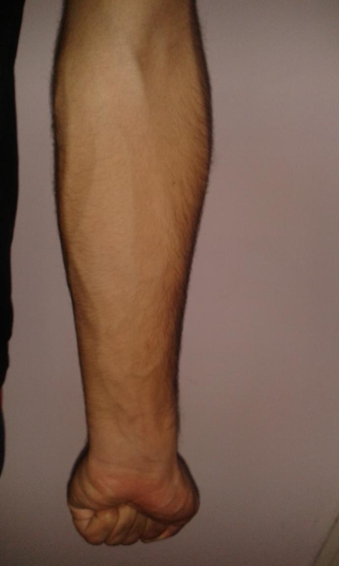 Damarları belirgin kola sahip erkekleri çekici buluyor musunuz?