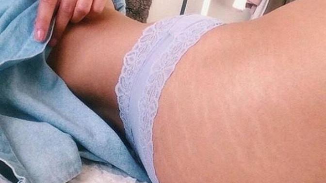 Sizce çatlakları olan kadınlar çok mu itici? Çatlaklara dövme yaptırmak iyi bir fikir mi?