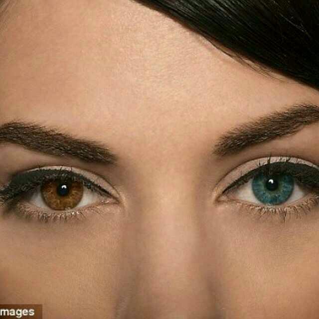 LUMİNEYES AMELİYATI HAKKINDA NE DÜŞÜNÜYORSUNUZ??
