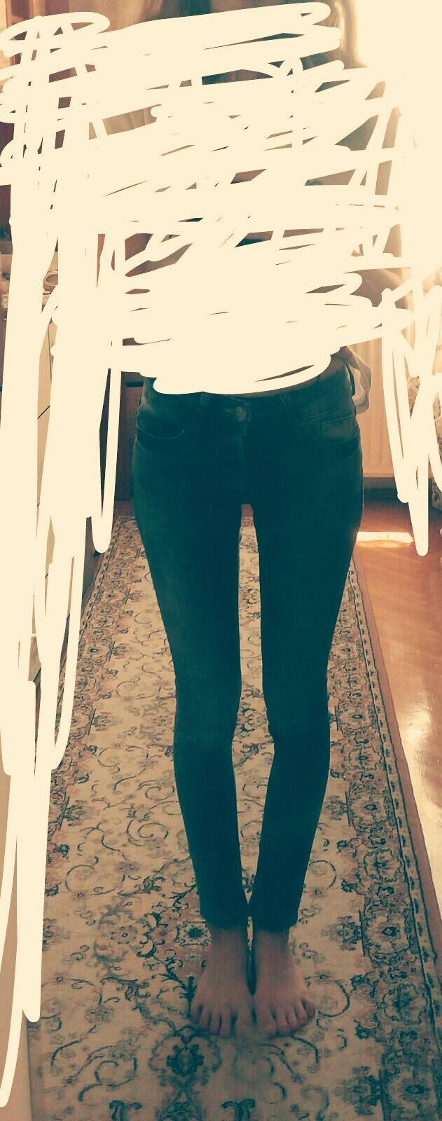 Bacaklarım çarpık mı yoksa zayıflıktan mı?(resimli)?