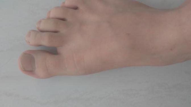 Ayak tırnaklarım neden böyle?