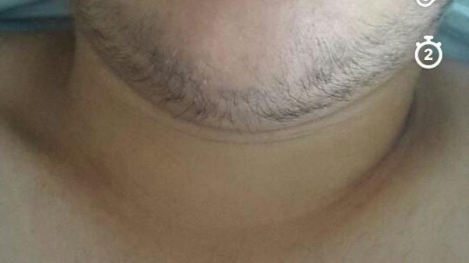 Heryerrde sakalim cikmiyor napcam?