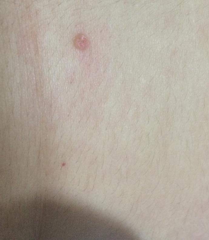 Bu sigil mi degil mi siğil kanaması ilgili bilgi?