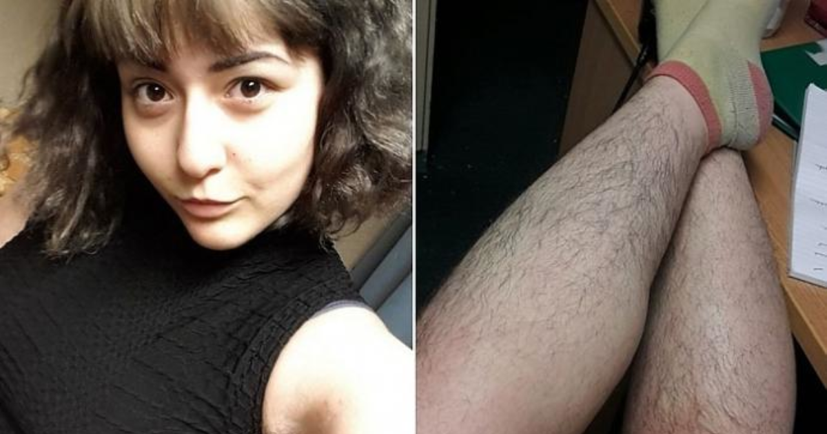 женщин волосатыми девушек с ногами фотографии и молодец, продолжай фотографии девушек и женщин с волосатыми ногами - 7