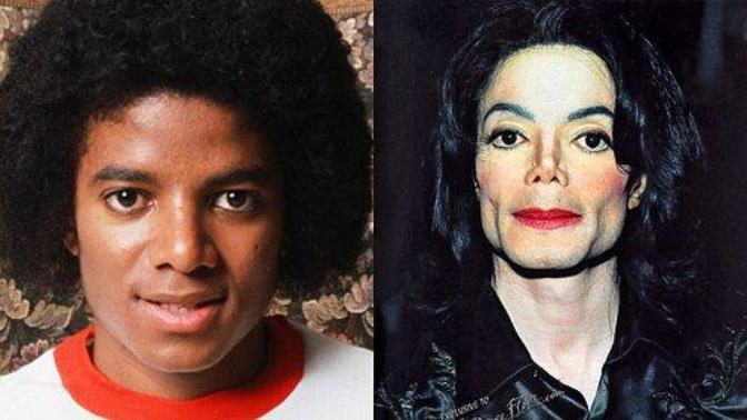 Michael Jackson'un Değişimi?