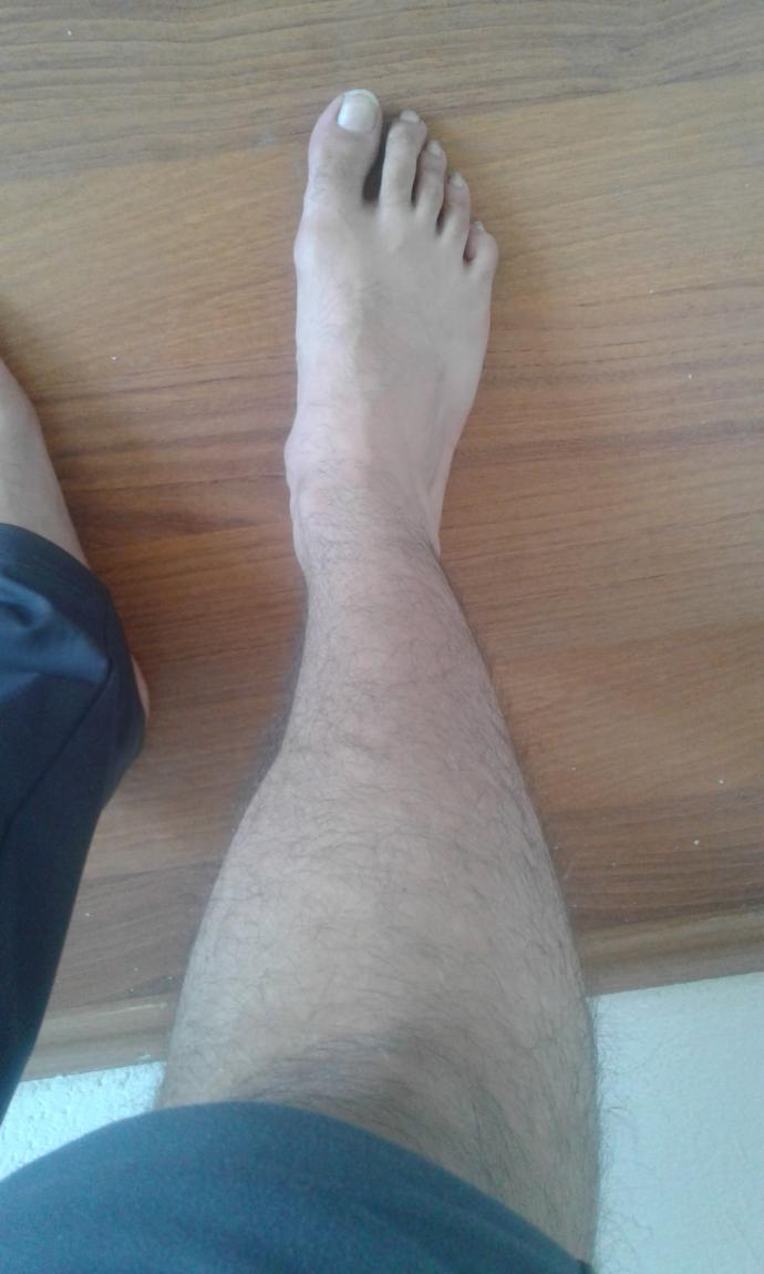 Bende raşitizm var bunu arkadaşlara söylemeye çekiniyorum ?