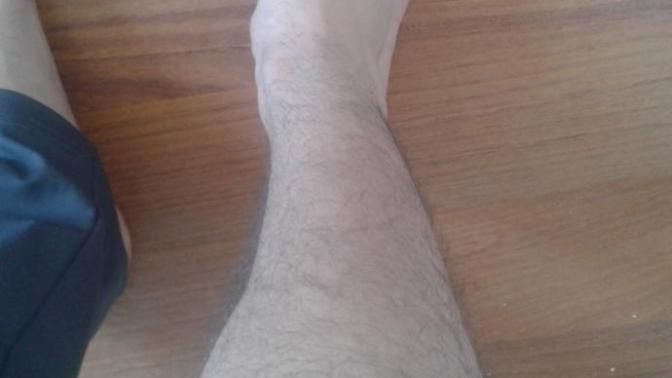 Bende raşitizm var bunu arkadaşlara söylemeye çekiniyorum?