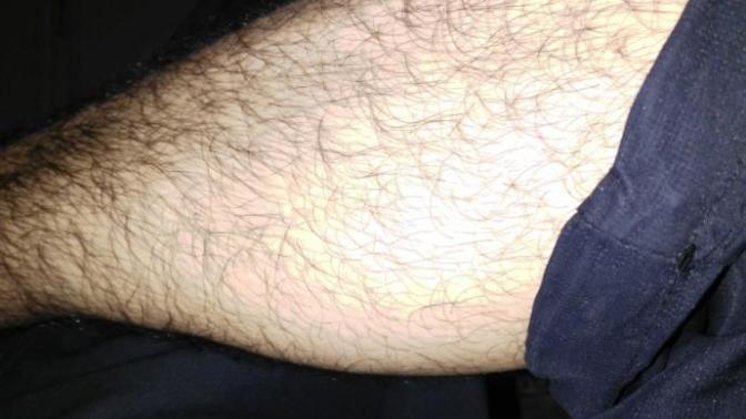 Kıllı bacak itici mi?