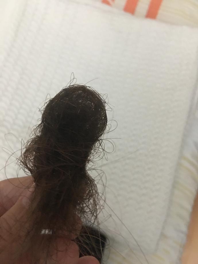 Saçlarım çok dökülüyor (fotolu)???????????????????