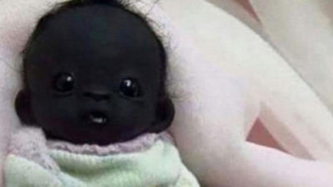 Eşim Zenci Çocuk Doğurdu Benden midir?