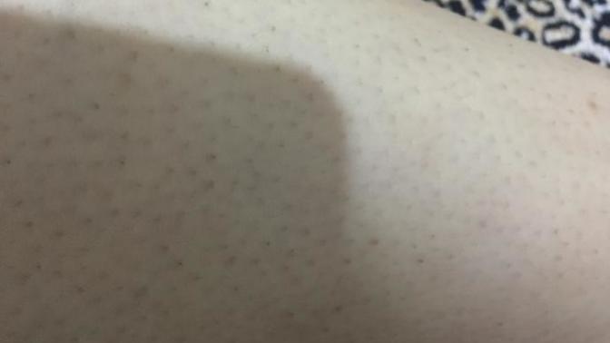 Fotoğrafa bakar mısınız bacağımı nasıl kurtarabilirim bu batıklardan?