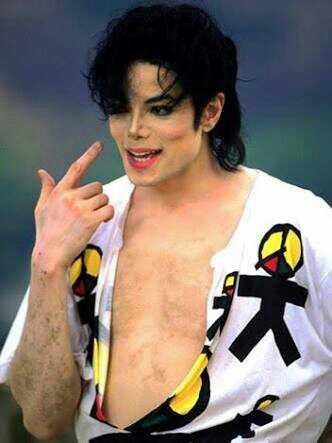 michael jackson da bir vitiligo hastasiydi. biliyormuydunuz??