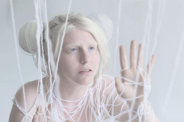 Albino nedir ? Albino olan bu hayvanları daha önce gördünüz mü ?