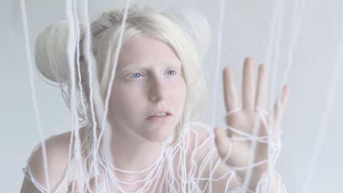 Albino nedir? Albino olan bu hayvanları daha önce gördünüz mü?