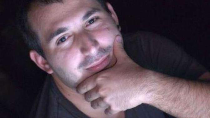 Alnım son zamanlarda şişti?