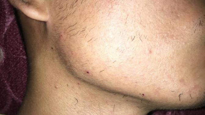 Köse miyim? 19 yaşındayım. (Fotoğraflı) ?