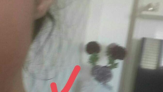 Omuz ve boyun aram neden çok çıkık?