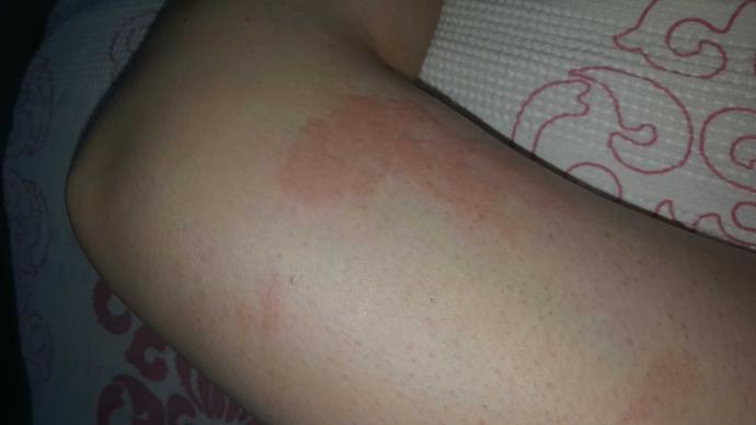 kızlar ağda sorunsalı bacağın çok kotu durumda ne yapacagin ??