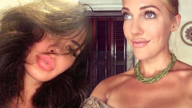 Son günlerde birçok ünlü isim bu moda akımına kapıldı: Ördek dudak out, köfte dudak in! Köfte dudaklar için dolgu yaptırır mısın?