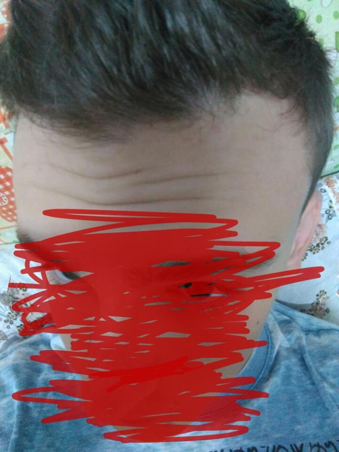 Lütfen bakın saçların dipleri acilmaya basladi sac derimde sizce bir hastalikmi var yoksa kellik baslangicimi var ?