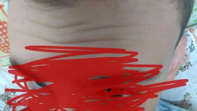 Saçlarımın dipleri açılmaya başladı saç derimde sizce  bir  hastalık mı var yoksa kellik başlangıcı mı var?