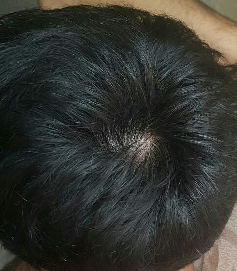 Sizce saçlarım seyrek mi??