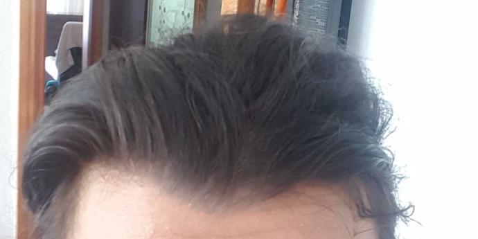 Saçlarım neden düz değil?
