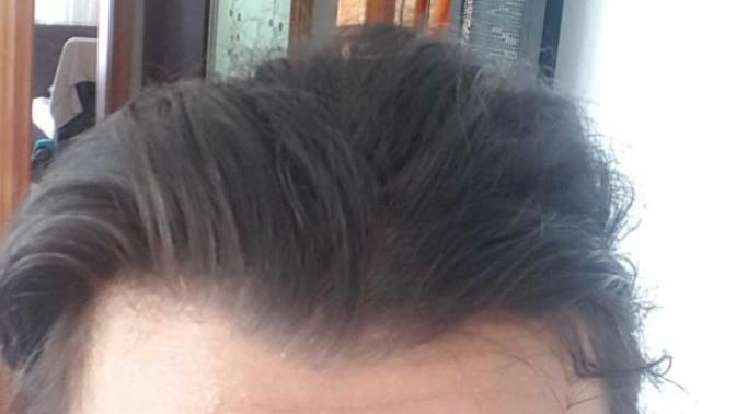 Saçlarım neden düz değil?