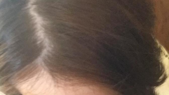 Saçlarım seyrek mi sizce :( ?