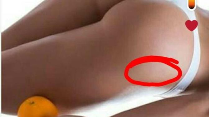 Squat kalça boşluğu dolar mi?