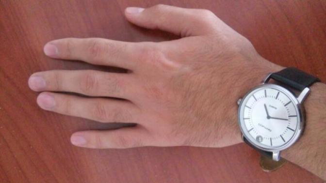 Elde kıl var. İtici duruyor mu?