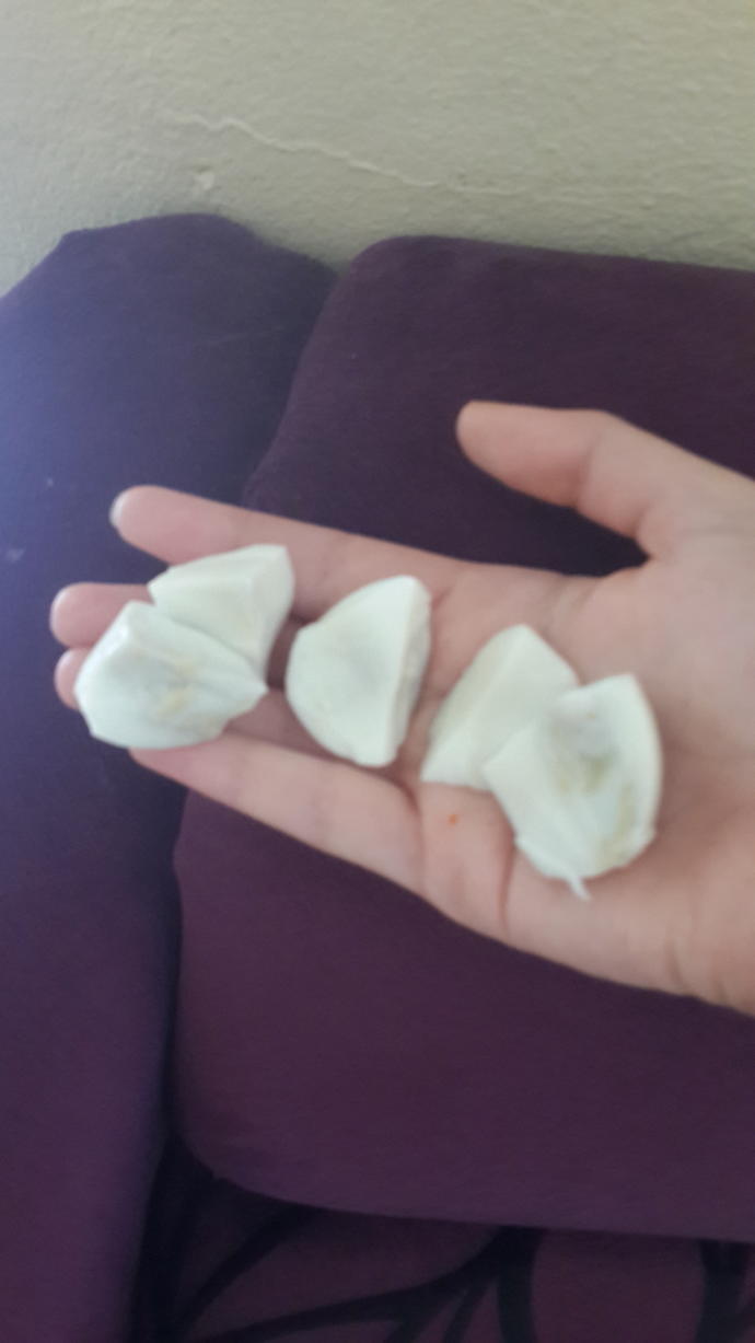Siz hiç sarısı olmayan yumurta gördünüz mü?Bu hormonlu olduğuna mı işaret eder?