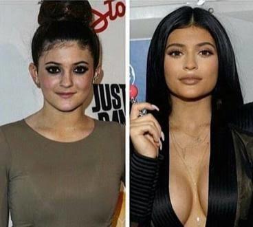 Kylie Jenner güzel mi?