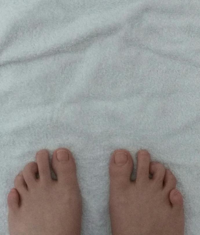 Ayak parmaklarım çok mu kötü?