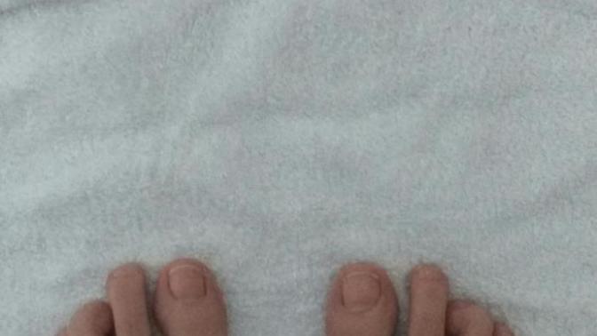 Ayak parmaklarım çok mu kötü?