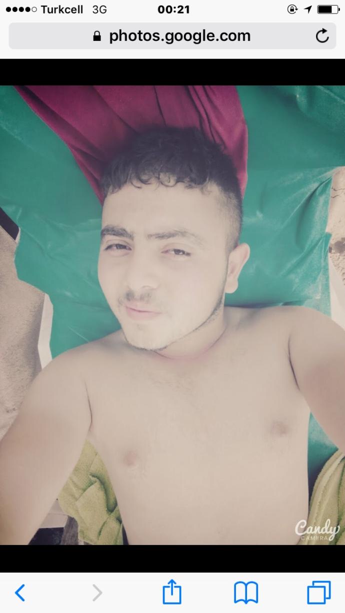 Yabancı kızlar sünnete neden karşı sizce ?