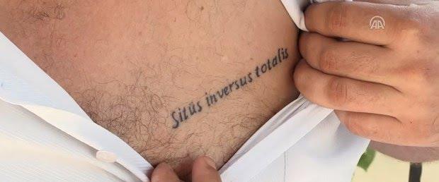"Dövmesinde "İç organlarım ters tarafta" yazıyor (Situs inversus totalis)" Dövme yaptırma hakkında düşünceleriniz nelerdir?