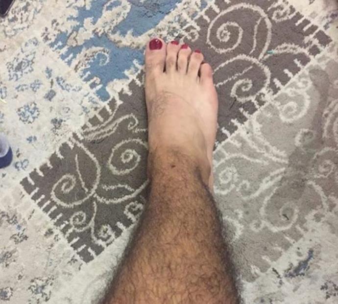 ağda vakti geldi önerdiğiniz ağda var mı?