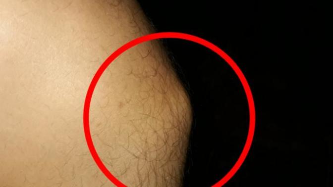 Arkadaşlar dizimde sislik var uzun zamandır ve her doktora gitmemde  bir  fayda goremedim tedavi olamadım sizce nedir bu?