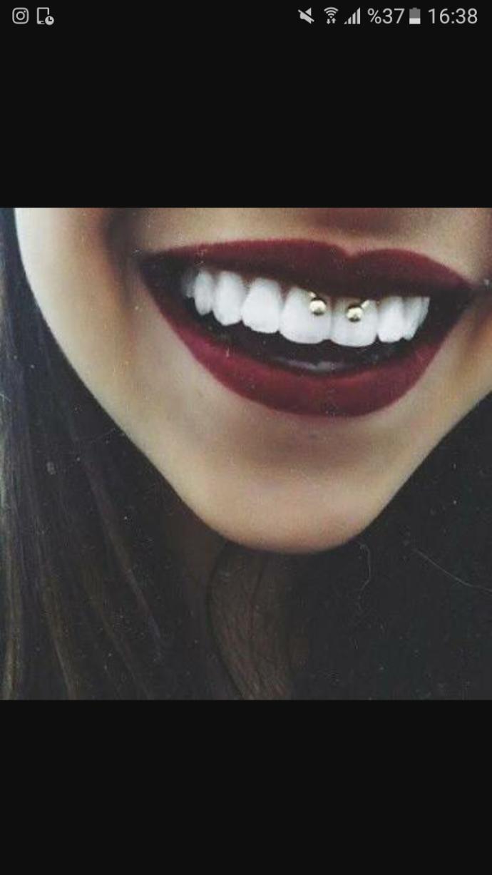 Smiley piercing ?