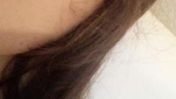 Fotoğraftaki tırnak izi geçer mi?