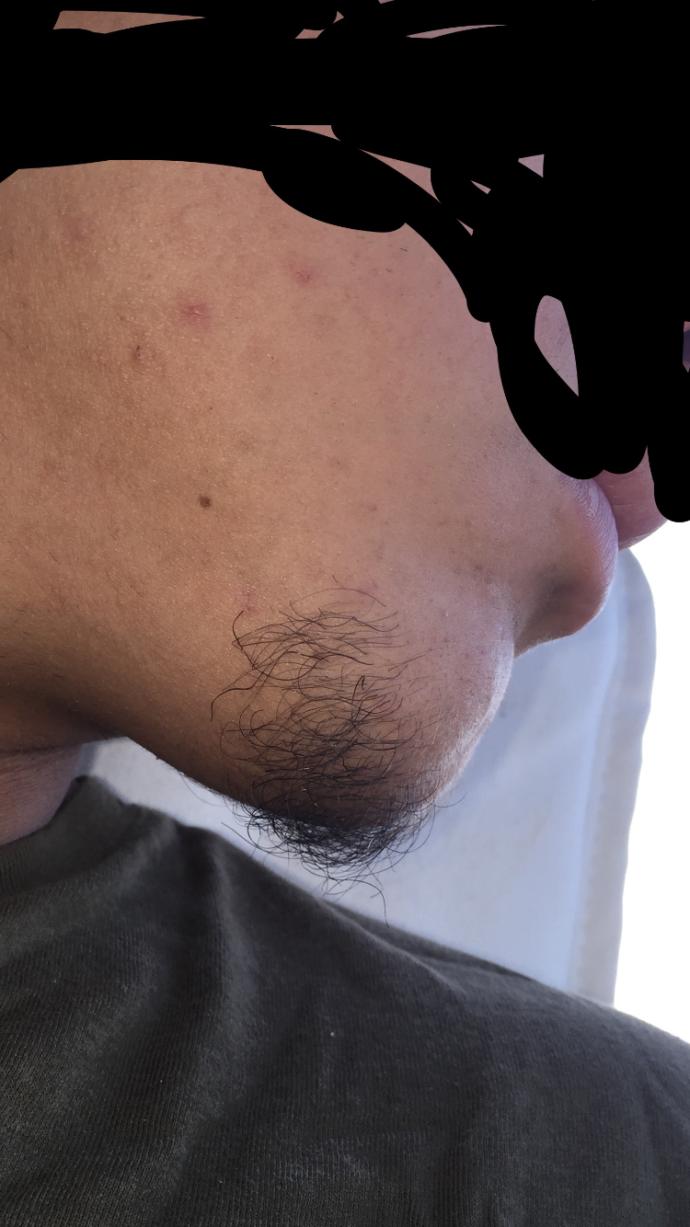 Sakalım henüz düzgün çıkmıyor sizce çenemdeki bu sakalı bırakayım mı keseyim mi?