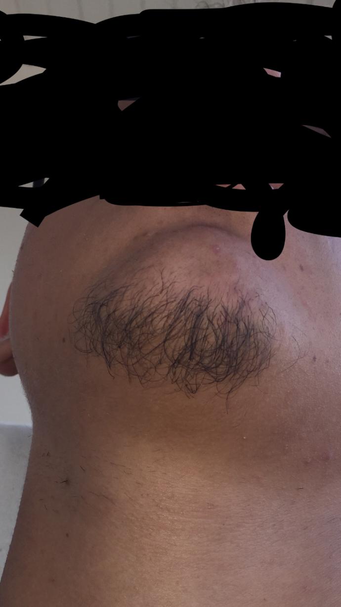 Sakalım henüz düzgün çıkmıyor sizce çenemdeki bu sakalı bırakayım mı keseyim mi?